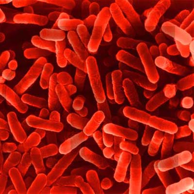 Legionnaire's Disease