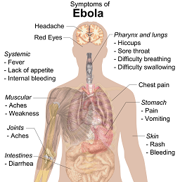Ebola 